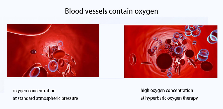oxygen concentration at different pressure.jpg